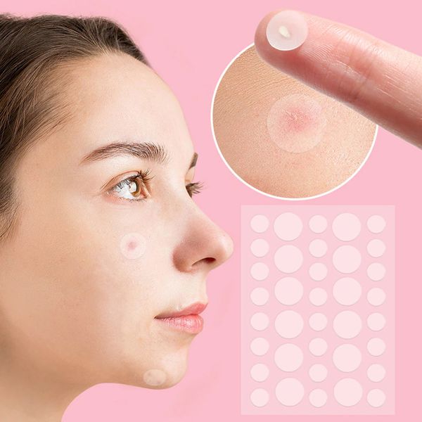 Патчі від прищів та акне 72 шт Acne Patch / Пластир косметичний для лікування акне 234574162 фото