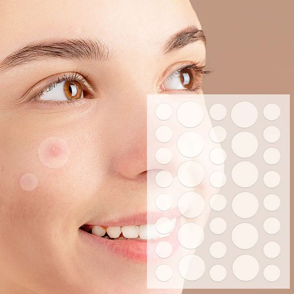 Патчі від прищів та акне 72 шт Acne Patch / Пластир косметичний для лікування акне 234574162 фото